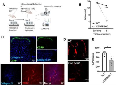 Spinal cord vascular degeneration impairs duloxetine penetration